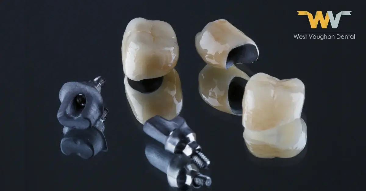 7 Benefits of All-Porcelain Dental Crowns