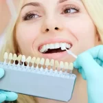 Resin Veneers vs Porcelain: What’s the Difference?