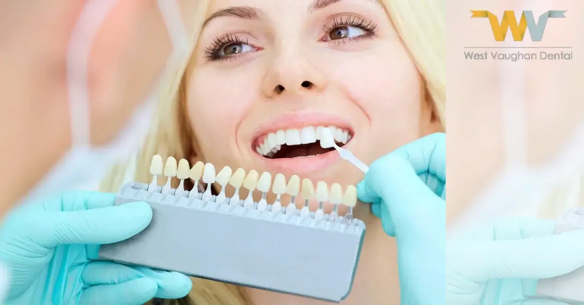 Resin Veneers vs Porcelain: What’s the Difference?