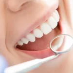 5-Popular-Cosmetic-Dentistry-Treatments
