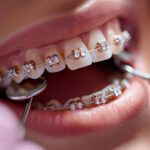 orthodontics Woodbridge