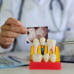 dental implants Woodbridge