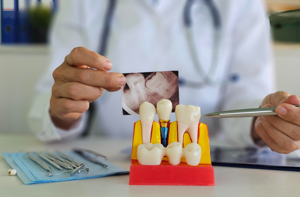 dental implants Woodbridge