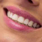 teeth whitening woodbridge