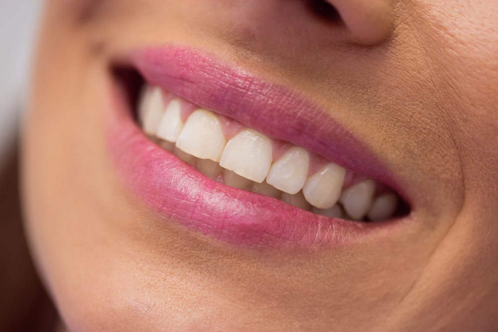 teeth whitening woodbridge